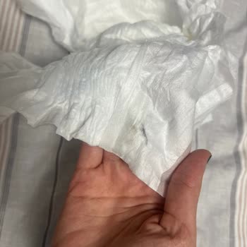 Molfix Bebek Bezi İçinde Sert Cisim Tespiti Ve Üretim Hatası Şikayeti