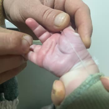 Damar Yolu Açmada İhmal Ve Yetersiz Mama Sebebiyle Bebekte Sağlık Riski