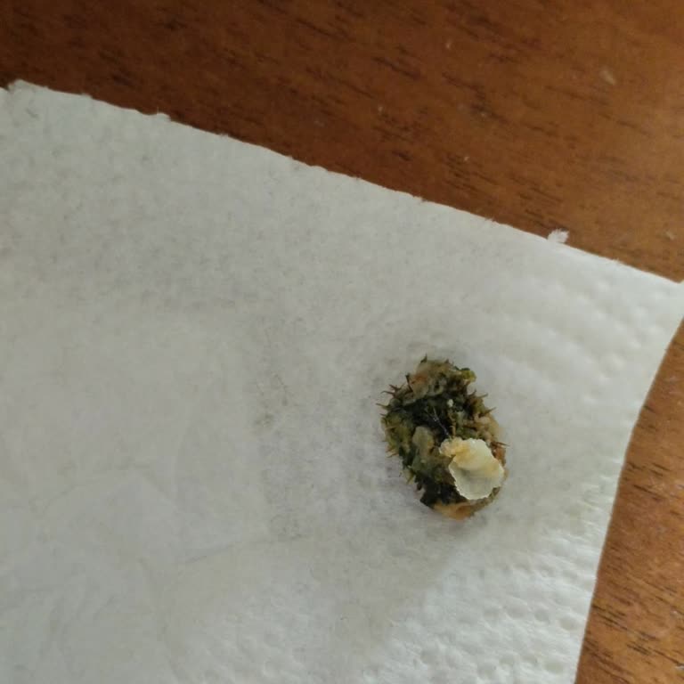 Migros Böreğinde Diken Bulunması Hijyen Ve Güvenlik Sorunu