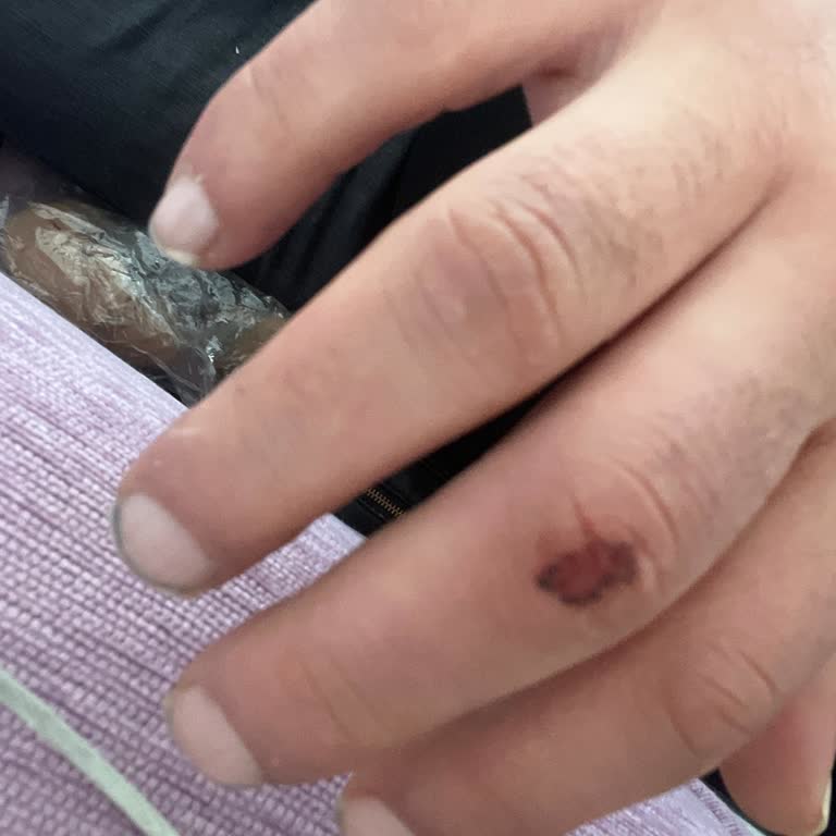 Moda Cazibe Yılbaşı Rezervasyonunda Fiziksel Şiddet Ve İlgisiz Servis