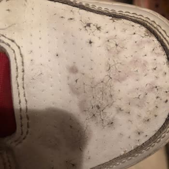 Nike Ayakkabının Derisinin Kısa Sürede Soyulması Ve Red Kararına İtiraz