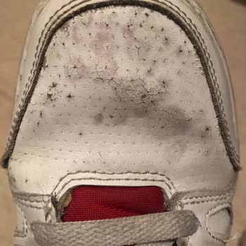 Nike Ayakkabının Derisinin Kısa Sürede Soyulması Ve Red Kararına İtiraz