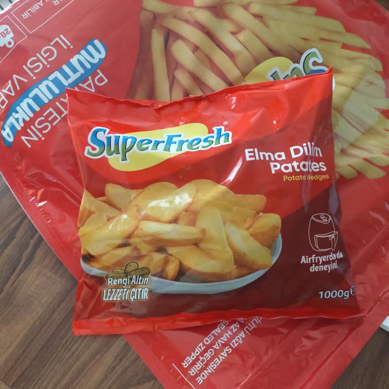 Dondurulmuş Patates Kızartmasında Taş Çıktı, Dişine Zarar Verdi