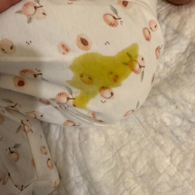 Prima Bebek Bezinde Sürekli Sızdırma Sorunu Ve İletişim Zorluğu