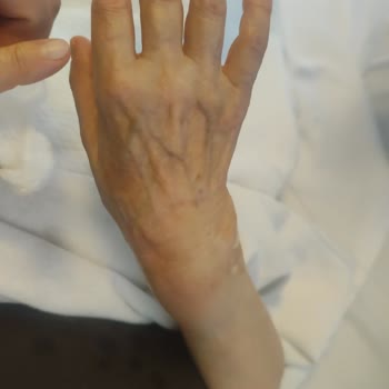 Kardiyoloji Yatışında Aç Bırakılma, Bilgi Eksikliği Ve Saygısız Tutum