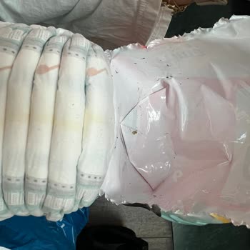 Prima Bebek Bezinde Yabancı Madde Tespiti ve Mağazanın İade Reddi