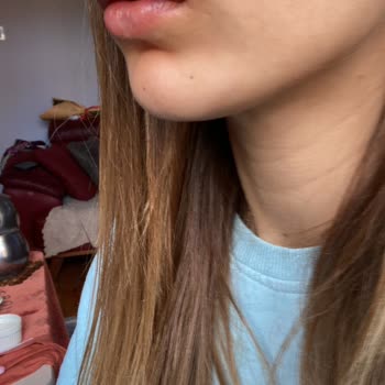 Op. Dr. Hasan Fındık Yanlış Dolgu, Şişmiş Dudak Ve Faturasız Ödeme Şikayeti