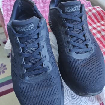 Ayıplı Skechers Ayakkabının İç Topuk Deformasyonu Ve Reddedilen İade Talebi