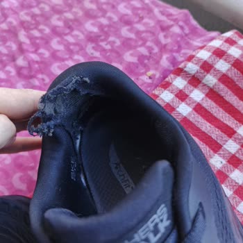 Ayıplı Skechers Ayakkabının İç Topuk Deformasyonu Ve Reddedilen İade Talebi