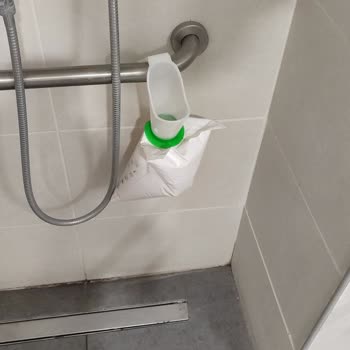 Kalp Ameliyatı Hastasının Oda Ve Tuvalet Temizliği İhmal Edildi