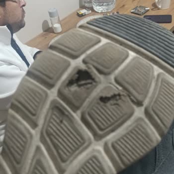 Skechers Ayakkabımda Taban Bozulması, Mağaza Çözüm Sunmuyor
