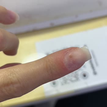 Valeria Platinum Beauty Levent Şubesinde Protez Tırnakta Mantar ve Hijyen İhmali