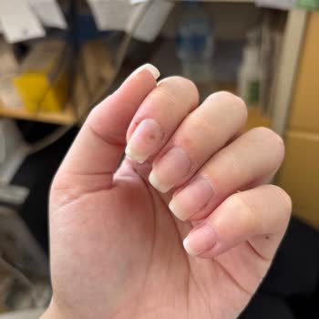 Valeria Platinum Beauty Levent Şubesinde Protez Tırnakta Mantar ve Hijyen İhmali