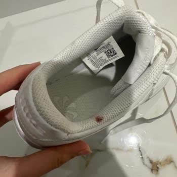 Nike Ayakkabısının Ağrılı Ve Kanamalı Tasarımı Nedeniyle Sağlık Sorunu Ve İade Talebi