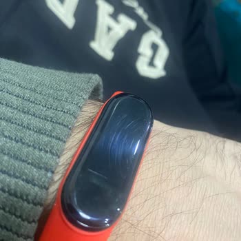 BİM Mağazasından Alınan Akıllı Bileklik Çizik Çıktı, Değişim Talebi