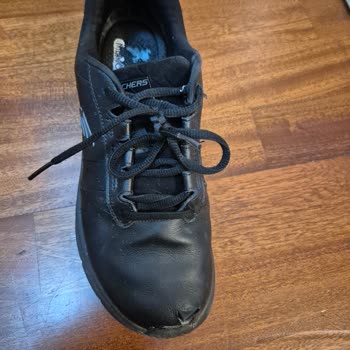 Kızımın Skechers Ayakkabısının Burun Kısmı Yırtıldı, Mağaza Kullanıcı Hatası Dedi