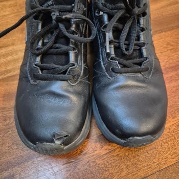 Kızımın Skechers Ayakkabısının Burun Kısmı Yırtıldı, Mağaza Kullanıcı Hatası Dedi