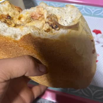 Kocaeli A101 Dönerinde Büyük Kemik Nedeniyle Hayati Boğaz Tıkanması Tehlikesi