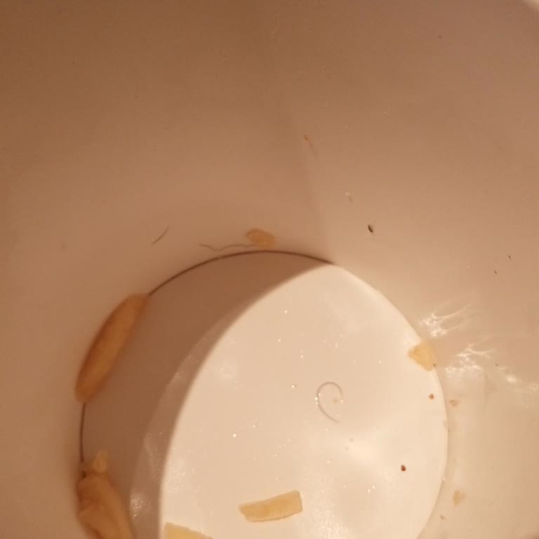 Patates Kovasından Kıl Çıkması Beni Son Derece Rahatsız Etti