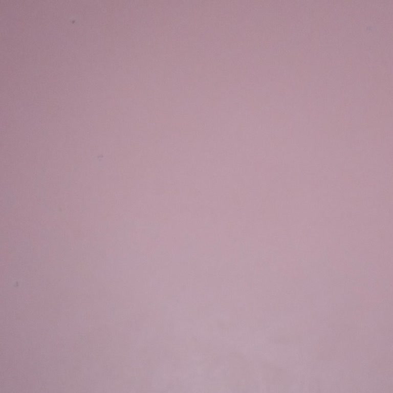 Yeni Renault Megane'de Sürekli Akü Zayıf Uyarısı Ve Garanti Çözümü Talebi