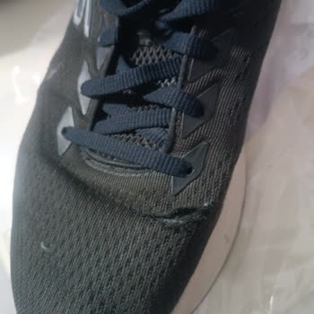 Yüksek Fiyatlı Skechers Ayakkabının Kısa Sürede Yırtılması Ve Kullanıcı Hatası İddiası