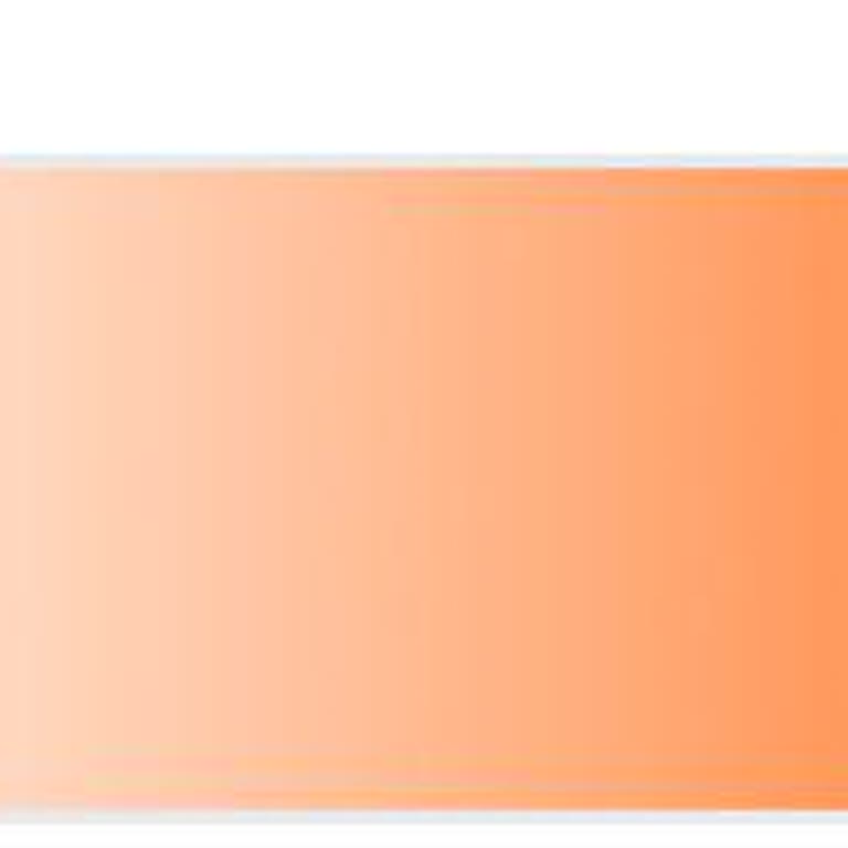 Money Puanım Erken Silindi, Kampanya Tarihine Uymadığınız İçin Güvenim Sarsıldı