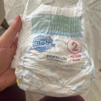 Molfix Bebek Bezinde Yabancı İçerik Bulunması Acil İnceleme Talebi