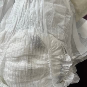 Molfix Bebek Bezinde Yabancı İçerik Bulunması Acil İnceleme Talebi