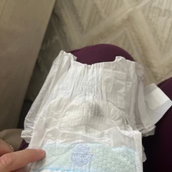 Molfix Bebek Bezinde Yabancı İçerik Bulunması Acil İnceleme Talebi