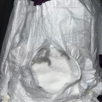 Molfix Bebek Bezinde Yabancı İçerik Bulunması Acil İnceleme Talebi