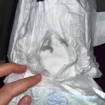 Molfix Bebek Bezinde Yabancı İçerik Bulunması Acil İnceleme Talebi