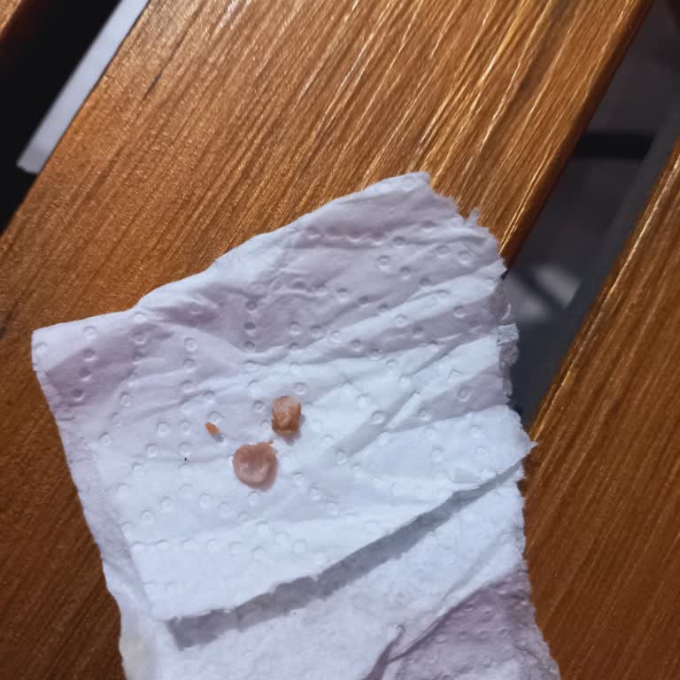 Migros Uzman Kasap Köfte İçindeki Kemik Parçaları Sağlığımı Tehlikeye Atıyor