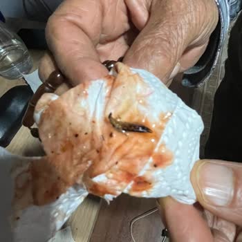 Komagene'de Böcekli Yemekte Hijyen Sorunu Ve İade Talebi