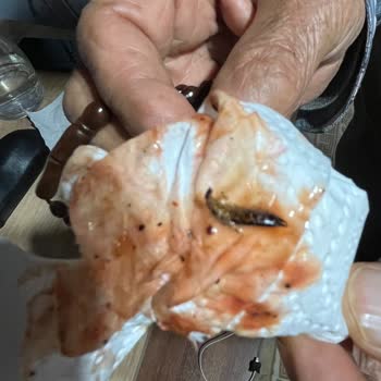 Komagene'de Böcekli Yemekte Hijyen Sorunu Ve İade Talebi