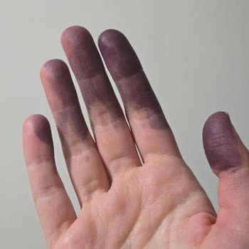 Yasin Pastanesi (Eskişehir) Pastadaki Gıda Boyası Pişman Etti