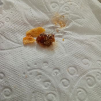 Doritos Hot Corn Çipsinde Yabancı Madde Tespit Edildi