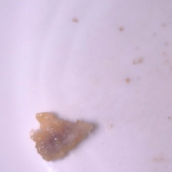 A101’te Satılan Burgerde Kemik Bulması Sağlık Tehlikesi Oluşturdu