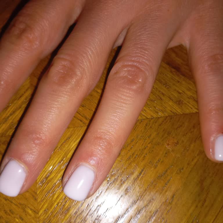 Manikür Ve Kalıcı Oje İşleminde Tırnak Etlerine Zarar Verildi