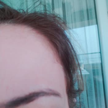 Faturasız Ödeme Ve Yanıltıcı Kaş Reklamı Sonucu Asimetrik Kaş