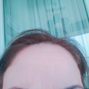 Faturasız Ödeme Ve Yanıltıcı Kaş Reklamı Sonucu Asimetrik Kaş