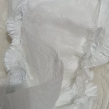 Molfix Bebek Bezinde Üst Bariyerin Yapışmaması Sorunu