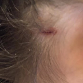 Milli Eğitim Bakanlığı Okulda Çocuğumuza Fiziksel Saldırı Ve Koruma İhmali