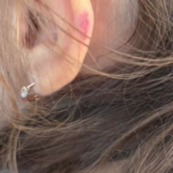 Milli Eğitim Bakanlığı Okulda Çocuğumuza Fiziksel Saldırı Ve Koruma İhmali