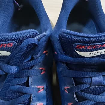 Skechers Arch Fit Ayakkabısında Kısa Sürede Yırtılma Ve Üretim Kusuru Reddi