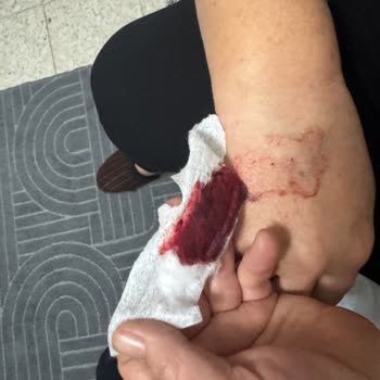 Metropol Sağlık Grubu Dama Yolu Açılması Sırasında Yaşanan Sorunlar!