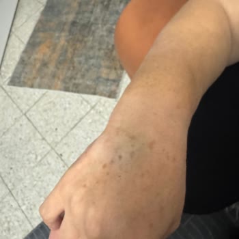 Metropol Sağlık Grubu Dama Yolu Açılması Sırasında Yaşanan Sorunlar!