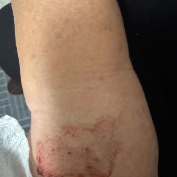 Metropol Sağlık Grubu Dama Yolu Açılması Sırasında Yaşanan Sorunlar!