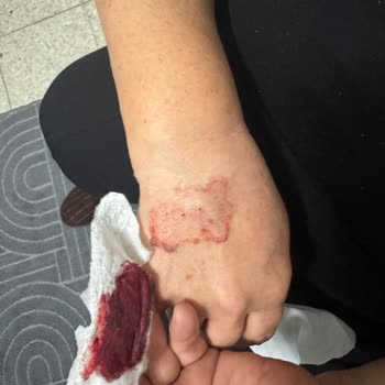 Metropol Sağlık Grubu Dama Yolu Açılması Sırasında Yaşanan Sorunlar!