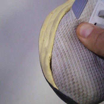 Adidas Ayakkabısının 1 Ayda Açılması Ve Amazon’un Yardım Etmemesi