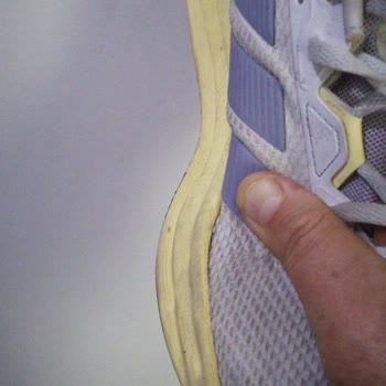 Adidas Ayakkabısının 1 Ayda Açılması Ve Amazon’un Yardım Etmemesi